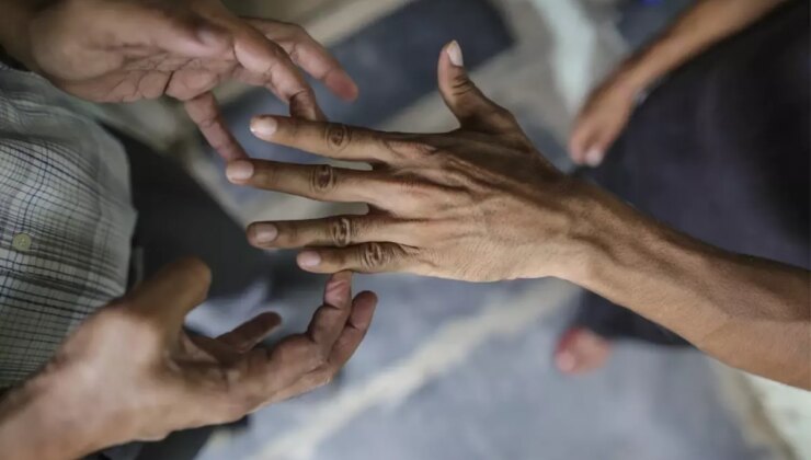 44 yıl sonra bir ilk! 2 ülkede cüzzam vakaları görülmeye başladı