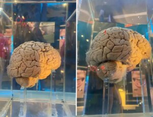 Amsterdam’daki dev arşiv: 5 bin 300 beyin yapay zeka ile haritalanacak