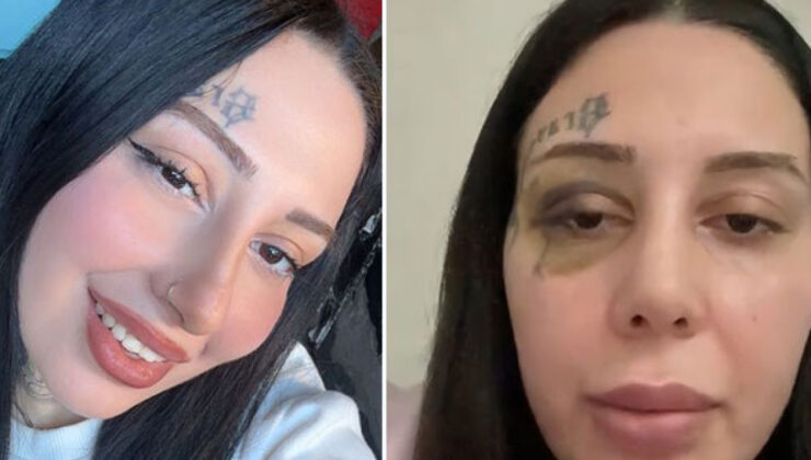 Cinsel istismar, tehdit ve şiddet… Dramdan burun estetiği çıktı!