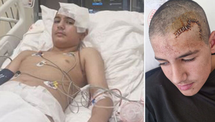 Şakalaştığı arkadaşı taşla kafatasını kırdı!